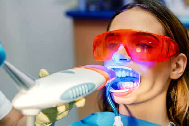 Simplifying Teeth Whitening: A Comprehensive Guide Aylesbury