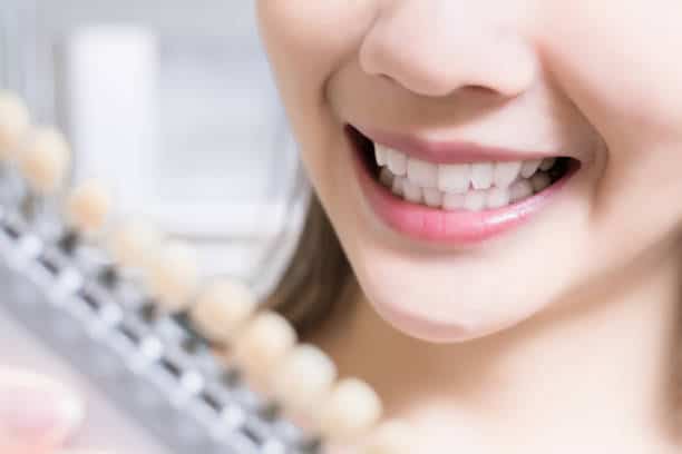 Teeth Whitening Kings Norton Aylesbury