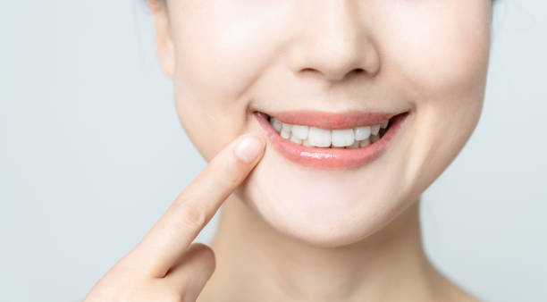 Comparing the Pain Factor: Laser Teeth Whitening vs. Zoom Teeth Whitening Aylesbury