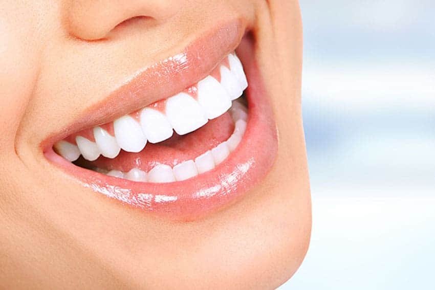 Teeth Whitening Abingdon Aylesbury