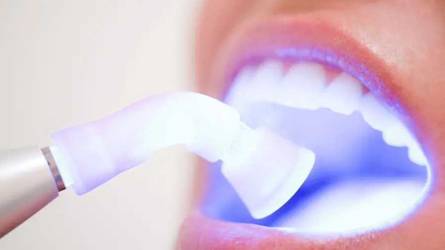 Teeth Whitening Aylesbury Aylesbury